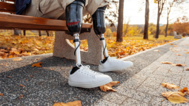 Custom prosthetic legs transform lives by enhancing mobility and restoring independence. Through personalized design and technological