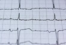 neural technology advancements discussed